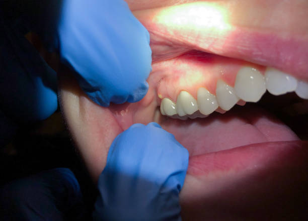 Best After-Hours Emergency Dentist in Angels, CA